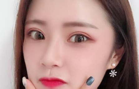 面部提升拉皮案例